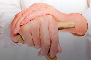 болка во зглобовите на прстите со ревматоиден артритис