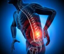 различни причини за болка во грбот