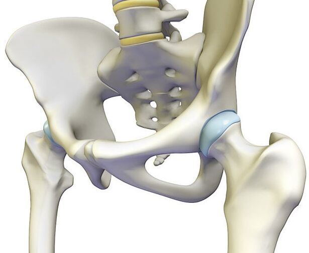 Остеохондрозата предизвикува остра болка во зглобот на колкот