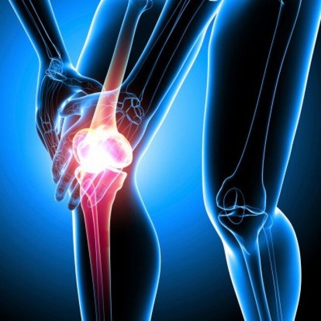 Ревматоидниот артритис во напредна фаза може да предизвика болка во колкот